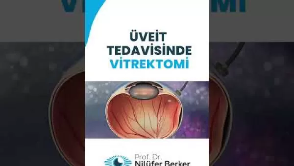 retina,retinacerrahisi,retinadekolmanı,üveit,üveitdoktoru,gözdoktoru,gözhastalıkları,katarakt,katarakttedavisi,gözkızarıklığı,gözkuruluğu,göztansiyonu,konjonktivit,skleral fiksasyon,behçet hastalığı,çocuklarda üveit,sarı nokta,sarı