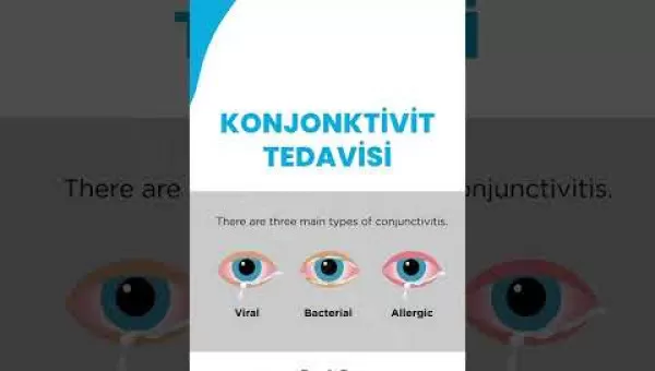 retina,retinacerrahisi,retinadekolmanı,üveit,üveitdoktoru,gözdoktoru,gözhastalıkları,katarakt,katarakttedavisi,gözkızarıklığı,gözkuruluğu,göztansiyonu,konjonktivit,skleral fiksasyon,behçet hastalığı,çocuklarda üveit,sarı nokta,sarı
