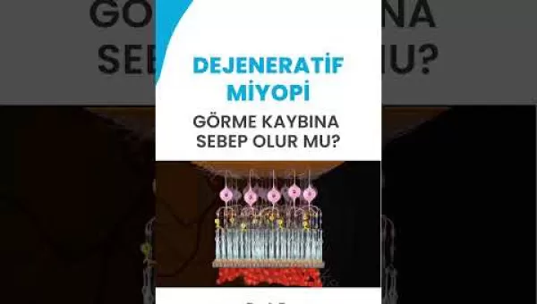 retina,retinacerrahisi,retinadekolmanı,üveit,üveitdoktoru,gözdoktoru,gözhastalıkları,katarakt,katarakttedavisi,gözkızarıklığı,gözkuruluğu,göztansiyonu,konjonktivit,skleral fiksasyon,behçet hastalığı,çocuklarda üveit,sarı nokta,sarı