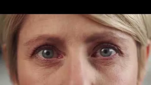 retina,retinacerrahisi,retinadekolmanı,üveit,üveitdoktoru,gözdoktoru,gözhastalıkları,katarakt,katarakttedavisi,gözkızarıklığı,gözkuruluğu,göztansiyonu,konjonktivit,skleral fiksasyon,behçet hastalığı,çocuklarda üveit,sarı nokta,sarı