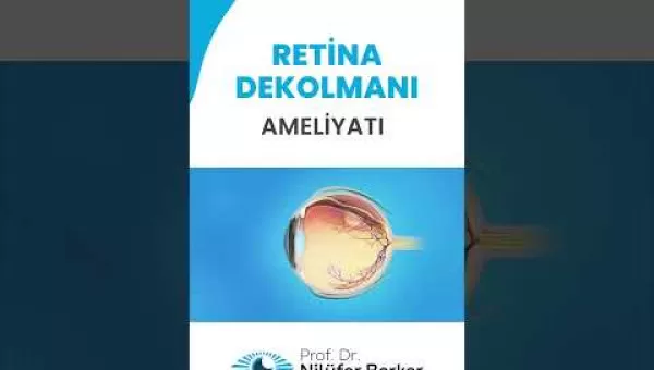 retina,retinacerrahisi,retinadekolmanı,üveit,üveitdoktoru,gözdoktoru,gözhastalıkları,katarakt,katarakttedavisi,gözkızarıklığı,gözkuruluğu,göztansiyonu,konjonktivit,skleral fiksasyon,behçet hastalığı,çocuklarda üveit,sarı nokta,sarı