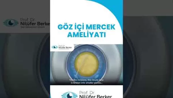 retina,retinacerrahisi,retinadekolmanı,üveit,üveitdoktoru,gözdoktoru,gözhastalıkları,katarakt,katarakttedavisi,gözkızarıklığı,gözkuruluğu,göztansiyonu,konjonktivit,skleral fiksasyon,behçet hastalığı,çocuklarda üveit,sarı nokta,sarı