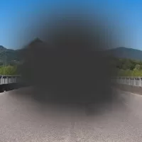 Sarı Nokta Tedavisi