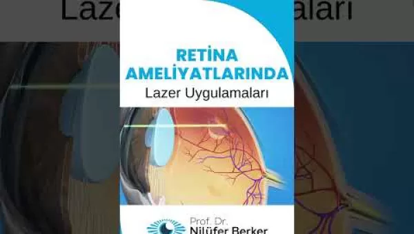 retina,retinacerrahisi,retinadekolmanı,üveit,üveitdoktoru,gözdoktoru,gözhastalıkları,katarakt,katarakttedavisi,gözkızarıklığı,gözkuruluğu,göztansiyonu,konjonktivit,skleral fiksasyon,behçet hastalığı,çocuklarda üveit,sarı nokta,sarı