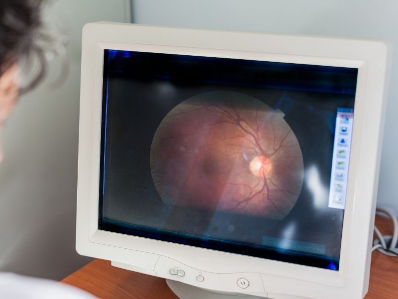 retina-ven-tikanikligi-belirtileri